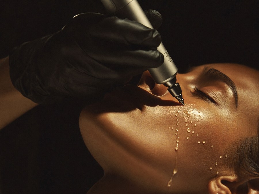 Microneedling